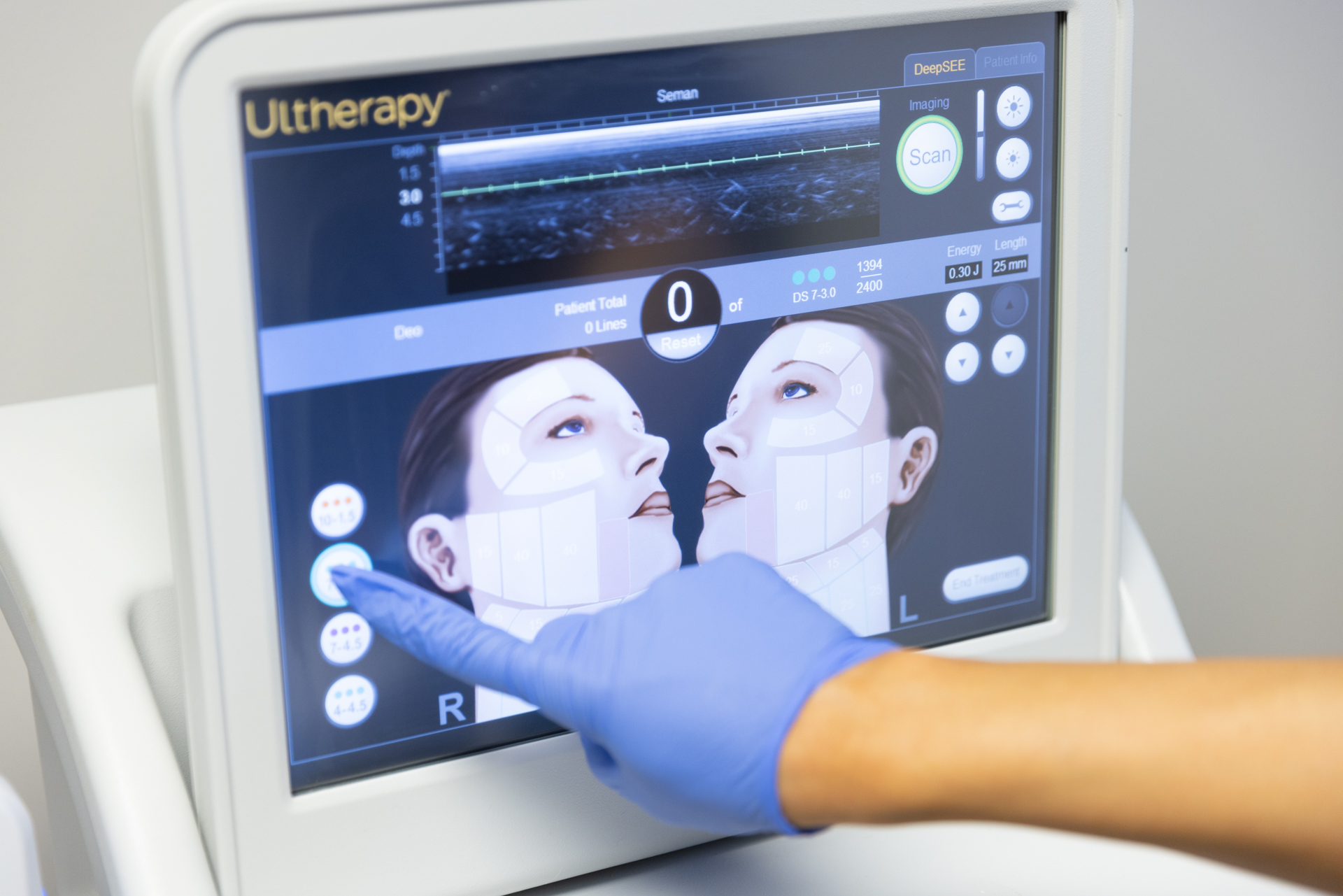 A provider prepares the Ultherapy device settings for a patient's under-eye rejuvenation in Indianapolis.