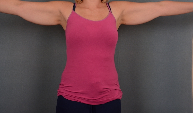 Woman in tank top in an image before an arm lift.