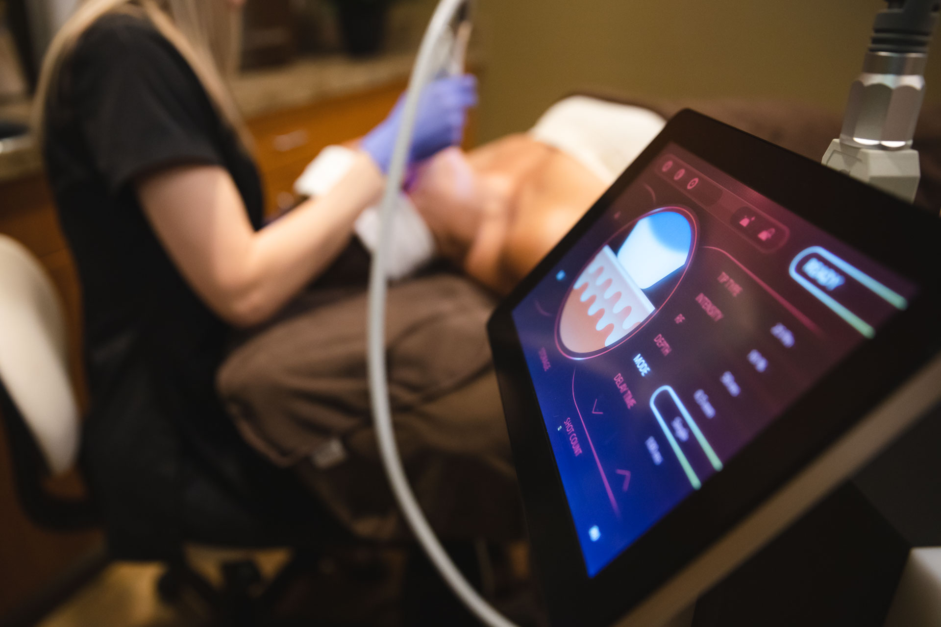 A provider administers RF microneedling, one of many options for skin tightening after lipo in Indiana.
