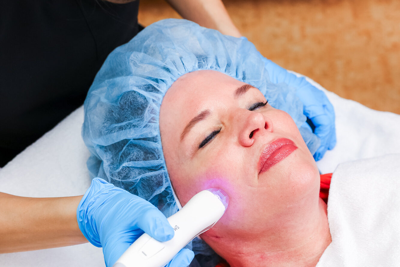 A provider uses an RF microneedling device to deliver skin tightening near Westfield.