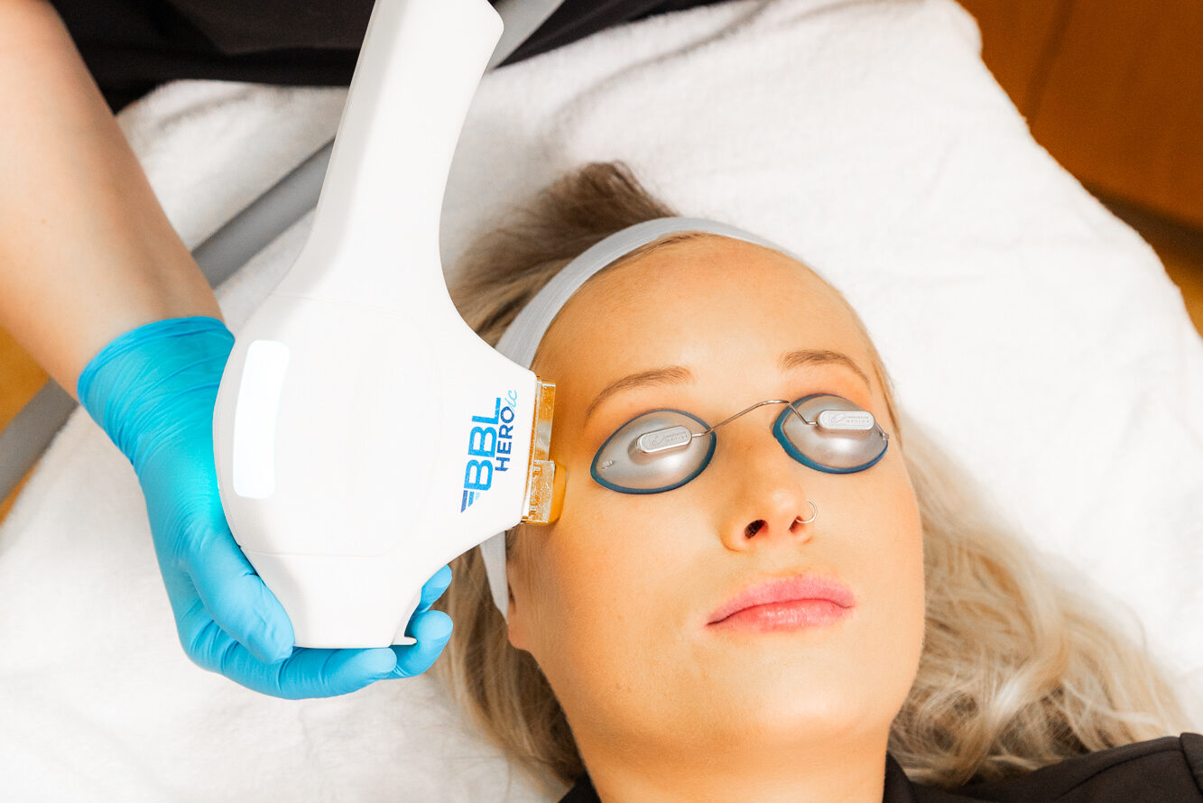Client receiving BBL treatment.